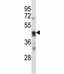 ARC Antibody