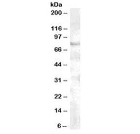 Western blot testing of human cerebellum lysate with FOXP2 antibody at 0.5ug/ml. Predicted molecular