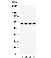 Western blot testing of 1) human placenta, 2) HepG2, 3) 293 and 4) HeLa lysate with HRPT2 antibody. 
