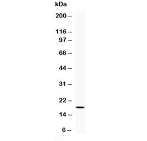 Human Interferon gamma Antibody