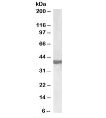 SH3GL2 Antibody