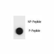 Phospho-TSC1 Antibody (pT310)
