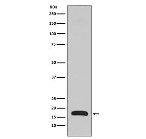 Western blot testing of human fetal brain lysate with p16 ARC antibody. Predicted molecular weight ~