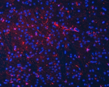 Immunofluorescent staining of FFPE mouse brain tissue with Septin 2 antibody (red) and DAPI nuclear 