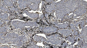 CMBL Antibody / LOC134147