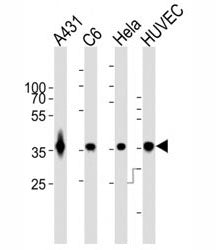 GAPDH Antibody