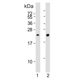 Pulmonary surfactant-associated protein C Antibody / SFTPC