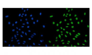 Immunofluorescent staining of FFPE human U-2 OS cells with PSD5A antibody (green) and DAPI nuclear s