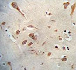 Neuroserpin Antibody / SERPINI1