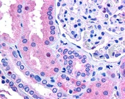 RNF213 Antibody