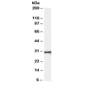 Western blot testing of human thymus lysate with HVEM antibody at 0.03ug/ml. Expected molecular weig