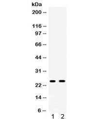 Western blot testing of 1) rat liver and 2) rat testis lysate with Apolipoprotein A I antibody. Pred