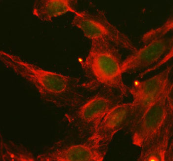 MAF Antibody / c-Maf, 100ug