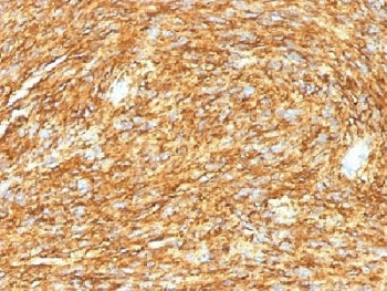 DOG1 Antibody / TMEM16A / ANO1