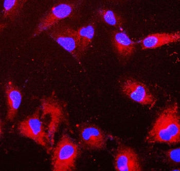 Peroxiredoxin 6 Antibody / PRDX6 / aiPLA2