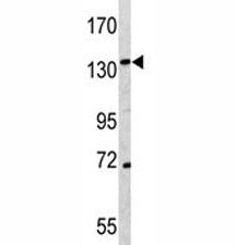 CD163 Antibody