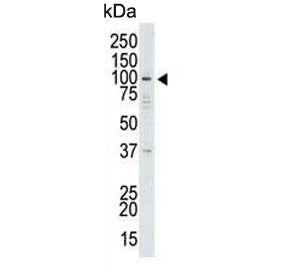 USP13 Antibody