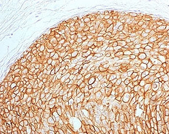 HER2 Antibody / ErbB2