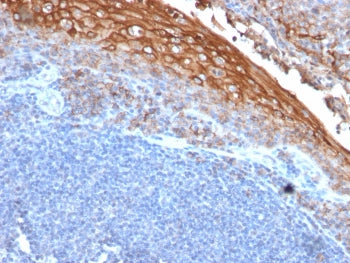 CD146 Antibody / MCAM / MUC18