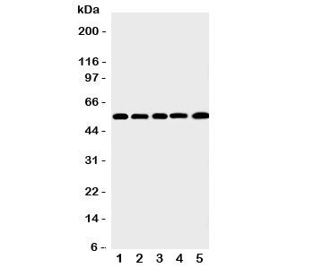 Western blot testing of MMP12 antibody and Lane 1: human SMMC-7721; 2: mouse HEPA; 3: (h) HeLa; 4: (