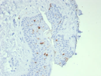 IHC staining of FFPE human skin tissue with Langerin antibody (clone LGRN/7541). HIER: boil tissue s