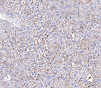 IHC staining of FFPE mouse liver tissue with Poliovirus Receptor antibody. HIER: boil tissue section