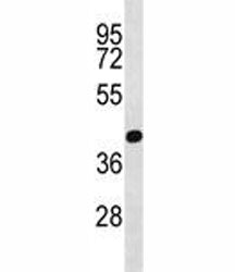 PRMT6 Antibody