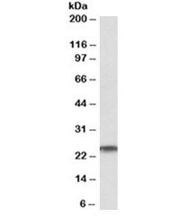 RAN Antibody