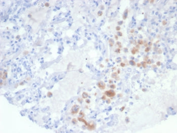 IRS1 Antibody