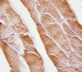 Immunohistochemical analysis of paraffin-embedded mouse skeletal muscle using Musk antibody at 1:25 
