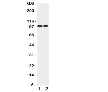 EPB41L1 Antibody