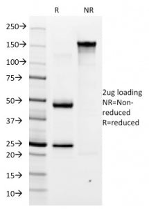 Helicobacter pylori Antibody