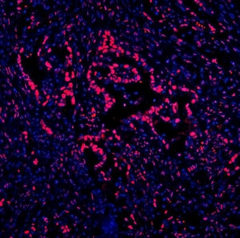 DDX5 Antibody