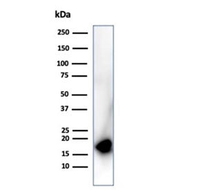 Western blot testing of human HepG2 cell lysate using CDKN2A antibody (clone rCDKN2A/4845). Predicte