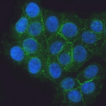 E-Cadherin Antibody / CDH1