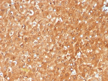 GCHFR Antibody / GFRP
