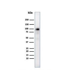 Western blot testing of human pancreas tissue lysate with Glycoprotein 2 antibody (clone GP2/3510). 