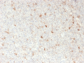 IHC staining of FFPE human lymph node with OX40 antibody. HIER: boil tissue sections in pH 9 10mM Tr