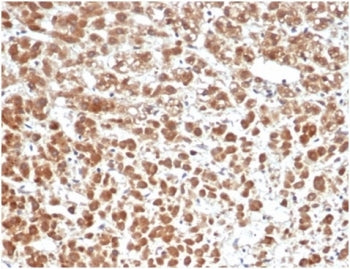 IHC staining of FFPE human adrenal gland tissue with IL1 beta antibody (clone IL1B/6687) at 2ug/ml. 