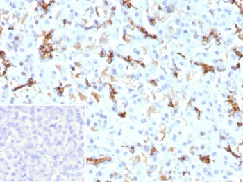 IHC staining of FFPE human pancreas tissue with recombinant CFTR antibody (clone CFTR/9148R). Inset: