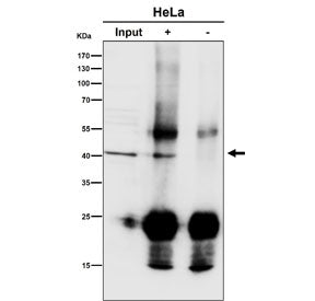 Immunoprecipitation of ACAT1 protein from 500ug of human K562 whole cell lysate with ACAT1 antibody 