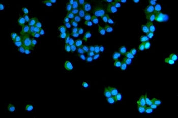 Immunofluorescent staining of FFPE human MCF7 cells with RAB5A/B/C antibody (green) and DAPI nuclear