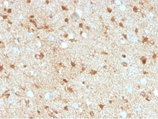 IHC staining of FFPE human brain tissue with S100 beta antibody (clone S100B/4149) at 2ug/ml. HIER: 