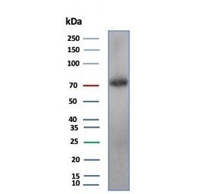 KIF2C Antibody / MCAK