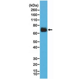 Recombinant Cyclooxygenase 2 Antibody / COX2 / PTGS2