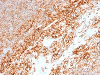 IHC staining of FFPE human tonsil with CD44 antibody (clone BU75). HIER: boil tissue sections in pH 