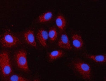 PXK Antibody / PX domain-containing protein kinase-like protein