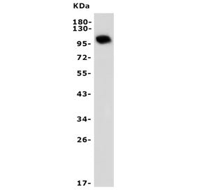 Western blot testing of mouse brain lysate with PDE10A antibody. Predicted molecular weight ~100 kDa