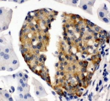 IBSP Antibody / Bone Sialoprotein2
