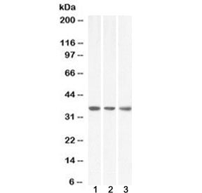 MDH2 Antibody / Malate dehydrogenase 2